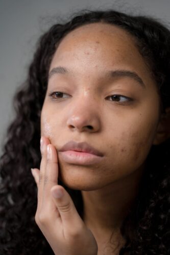 femme beau mat acne